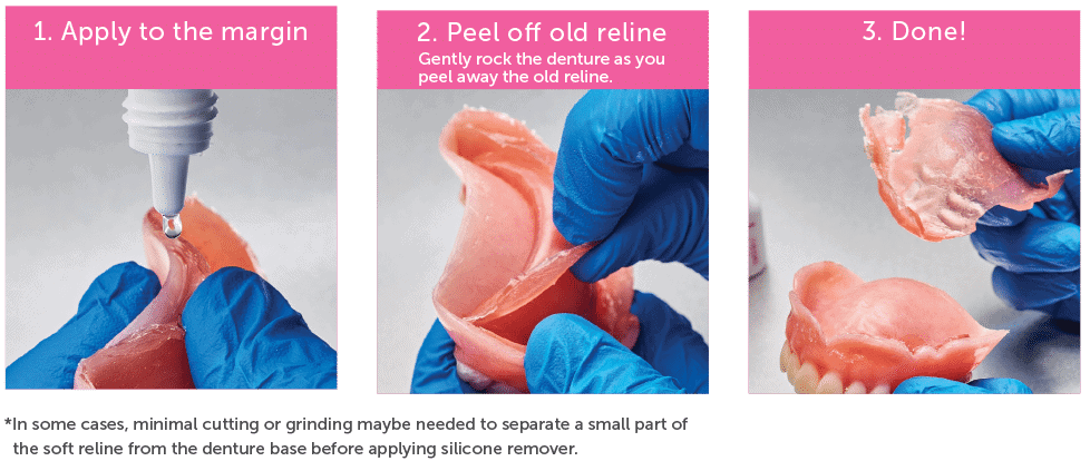 silicone_indication