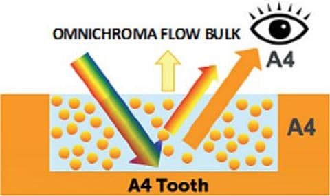 Excellent color match with A4 tooth image